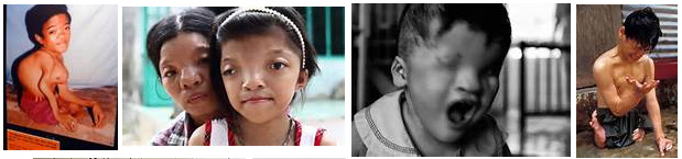 Gensch�den bei der vietnamesischen
                          Bev�lkerung durch Agent-Orange-Spr�haktionen